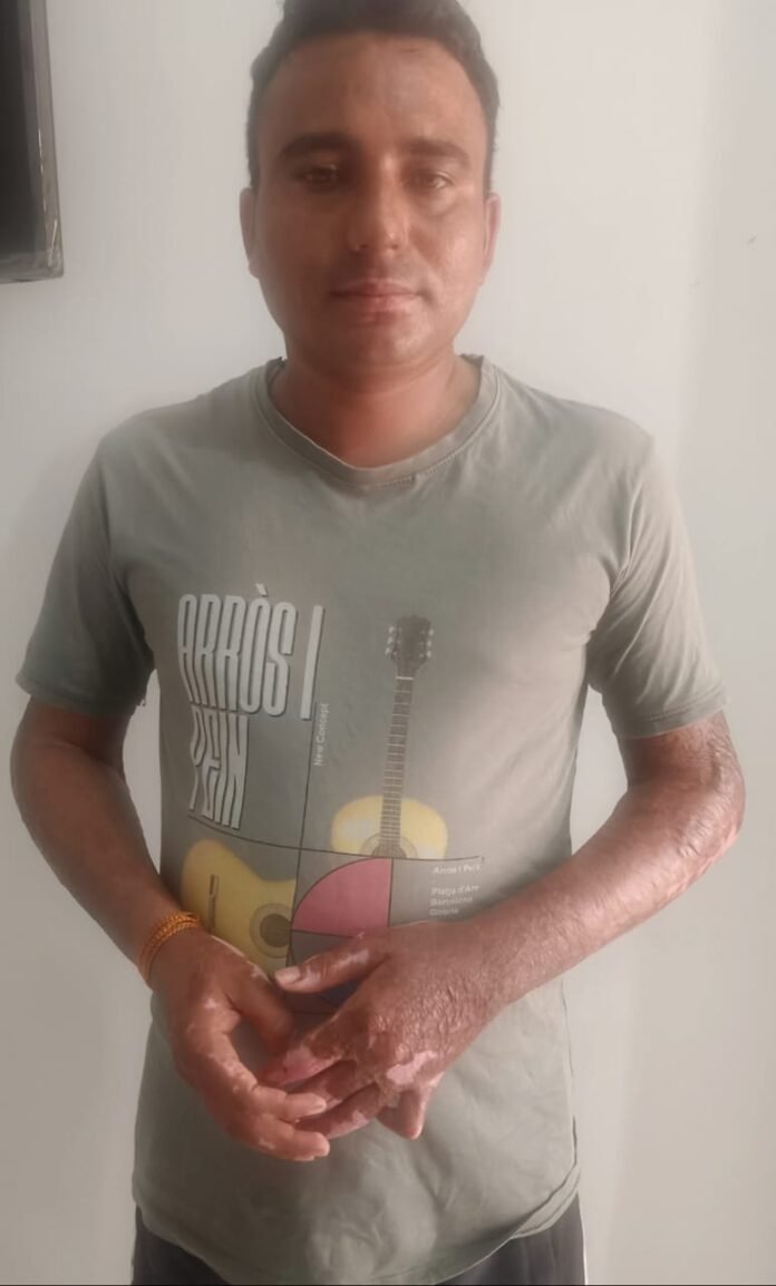 कम्पनी में ही कार्य के दौरान आग से झुलसने पर तथाकथित बड़ी फार्मा कम्पनी ने दरकिनार किया अपना ही कर्मचारी राहुल जनमन के अधिकारों के लिए किसी भी हद तक जाएगा जिला प्रशासन