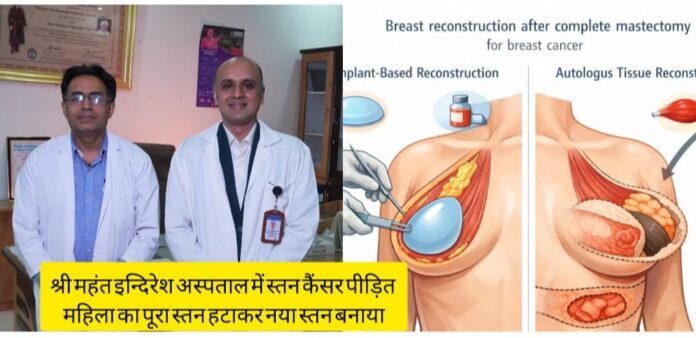 श्री महंत इन्दिरेश अस्पताल में स्तन कैंसर पीड़ित महिला का पूरा स्तन हटाकर नया स्तन बनाया
