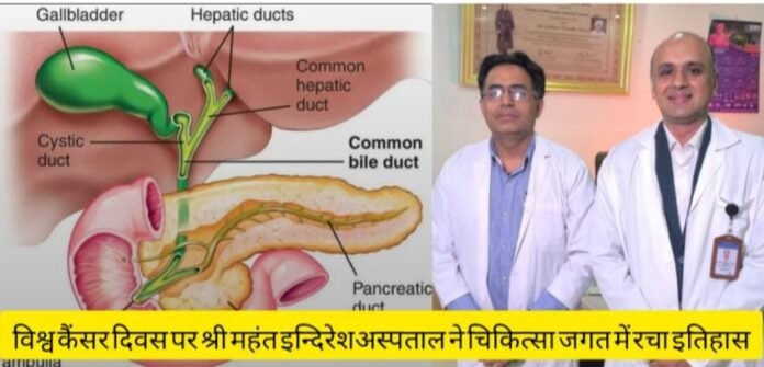 विश्व कैंसर दिवस पर श्री महंत इन्दिरेशअस्पताल ने चिकित्सा जगत में रचा इतिहास