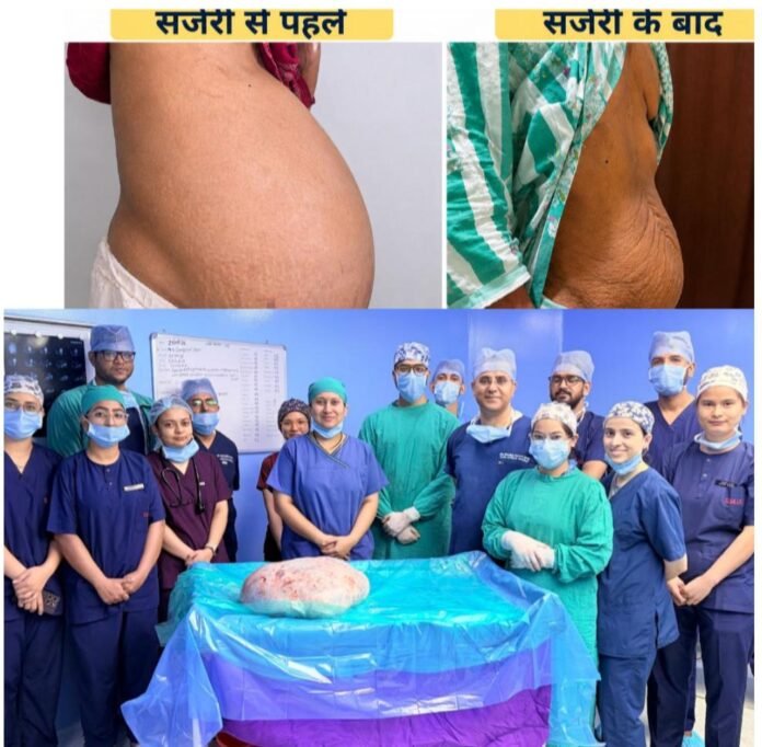 श्री महंत इन्दिरेश अस्पताल के कैंसर सर्जरी विभाग के डॉक्टरों ने एक 51 वर्षीय महिला के पेट से 15 किलो का ओवेरियन (अंडाशय) ट्यूमर सफलतापूर्वक निकालकर उसे नई ज़िंदगी दी