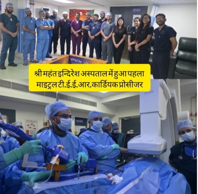 श्री महंत इन्दिरेश अस्पताल में हुआ पहला माइट्रल टी.ई.ई.आर.कार्डियक प्रोसीजर